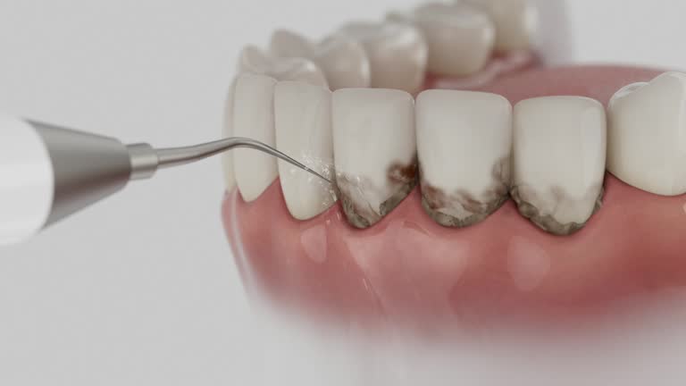 Trusted Tooth Extraction service in Eugene, OR - Dentist Open Now